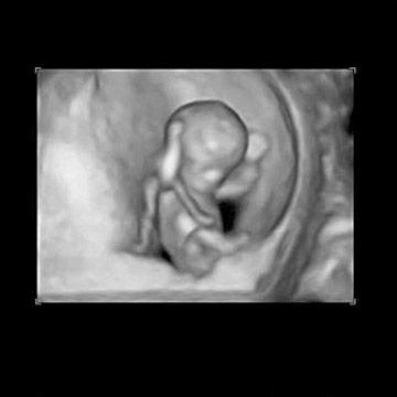 11 weeks fetus size