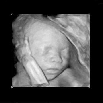 17 weeks pregnant fetus size