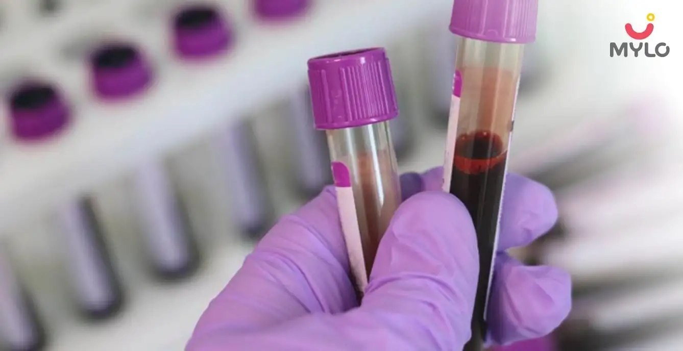 Image related to undefined