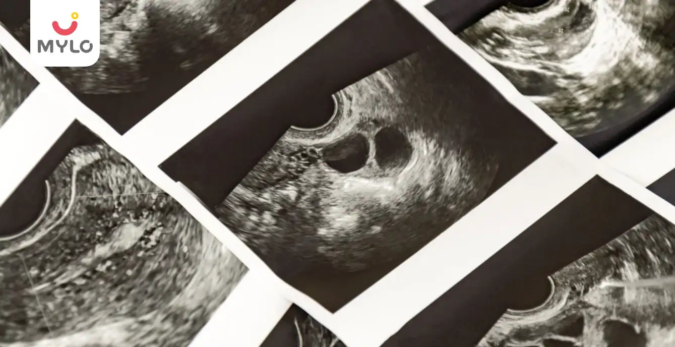 Image related to Scans & Tests