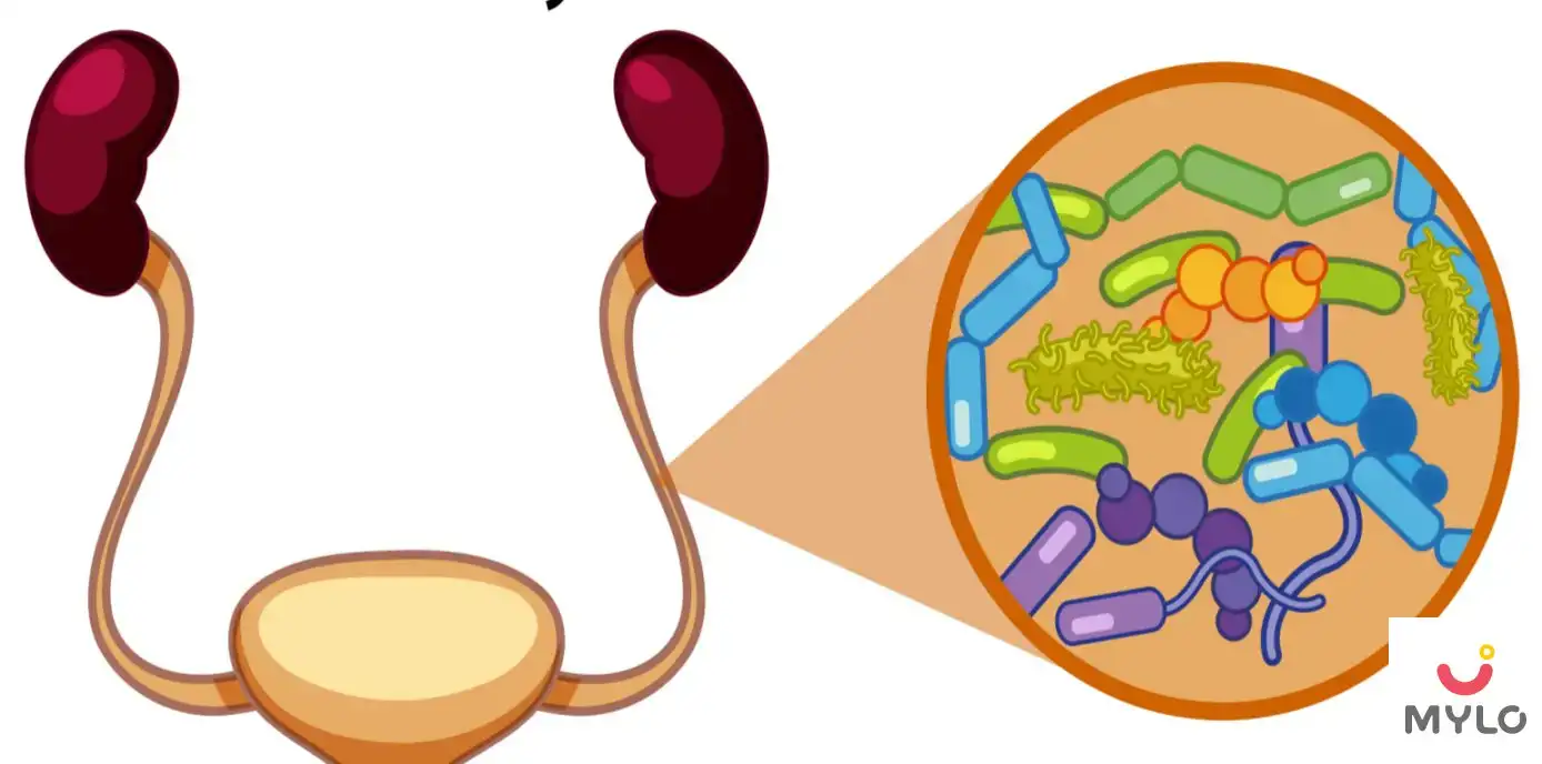 Image related to Urinary Tract Infections (UTI)