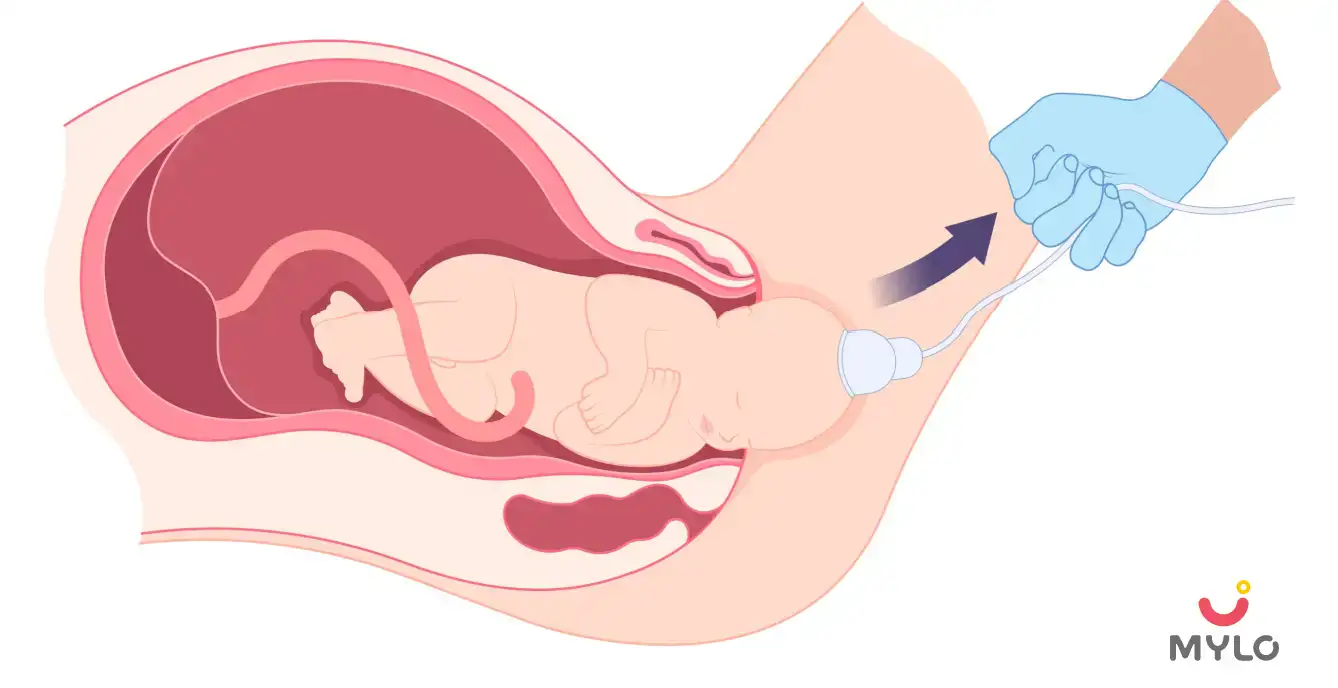 Image related to Tips For Normal Delivery