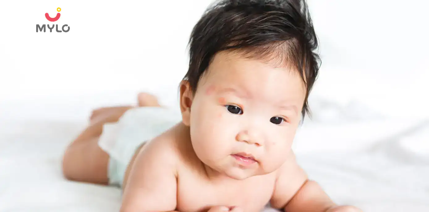 boils-in-babies-treatment-home-remedies