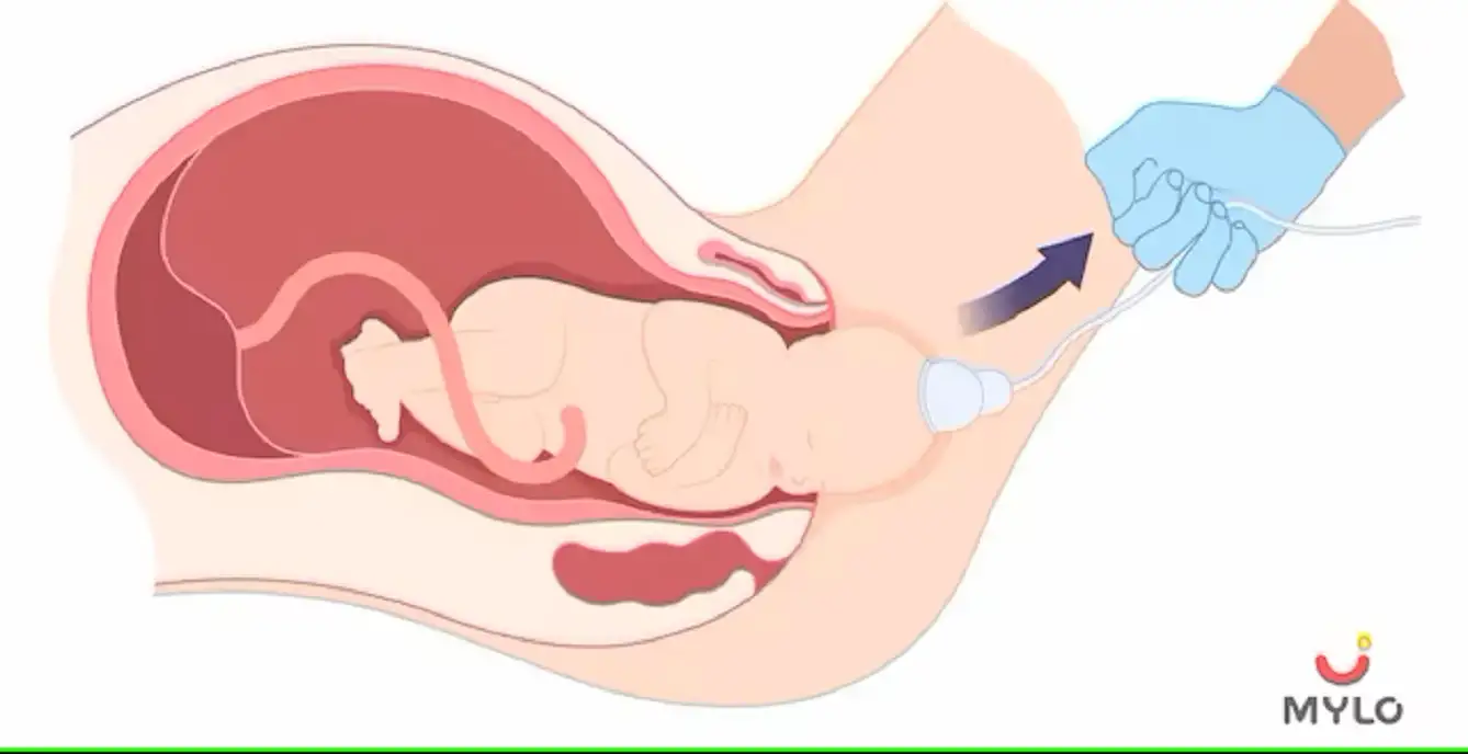 Image related to Labour & Delivery