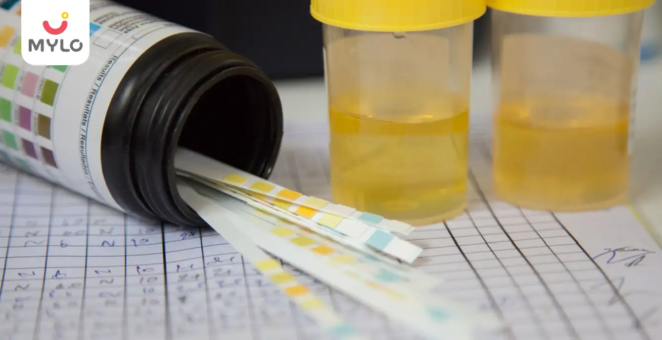 Image related to Urinary Tract Infections (UTI)