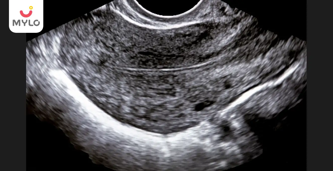 Image related to Conception