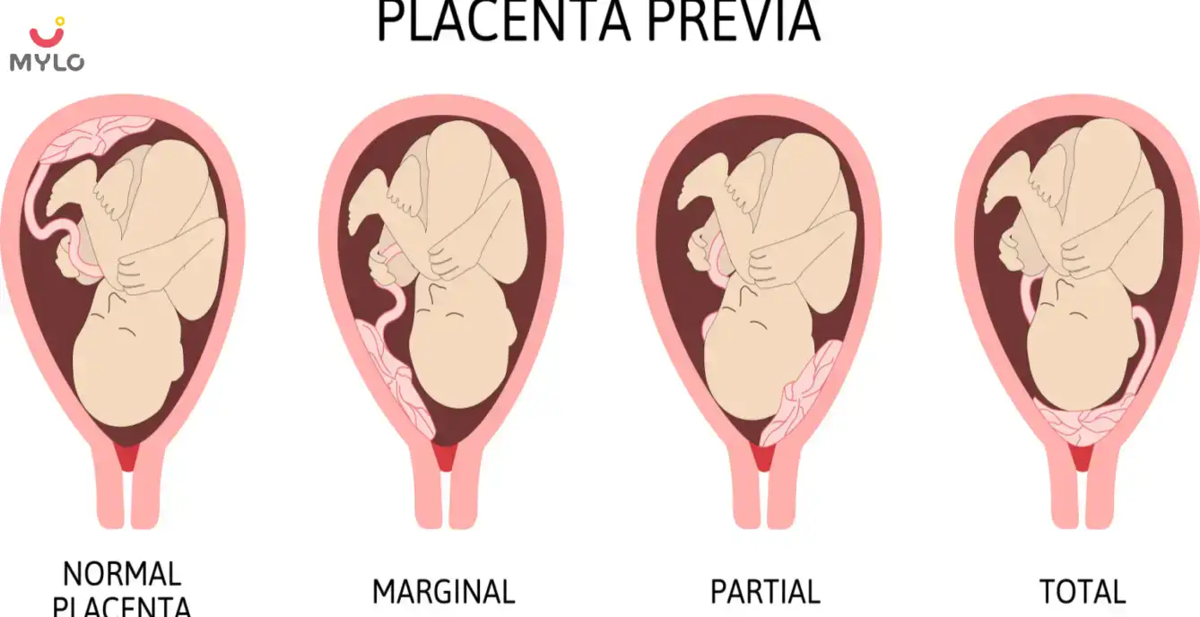 Image related to undefined