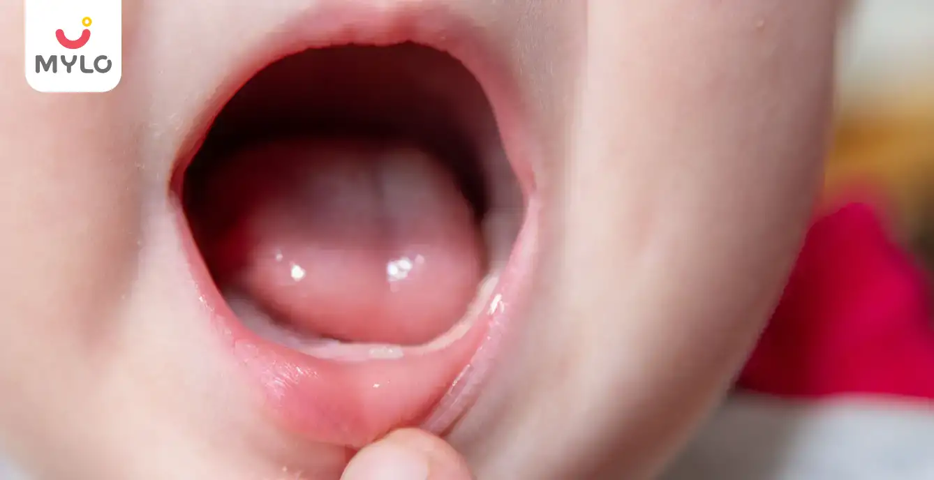 Image related to Teething