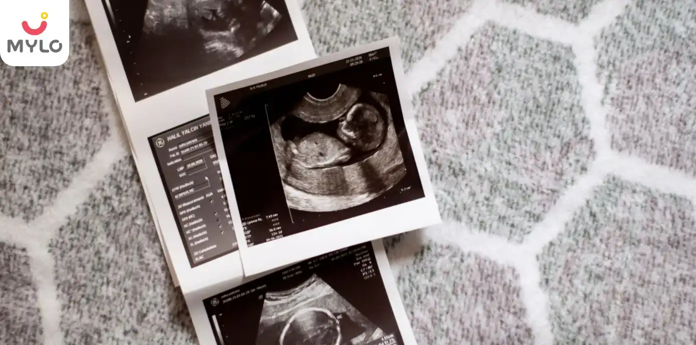 Image related to Scans & Tests