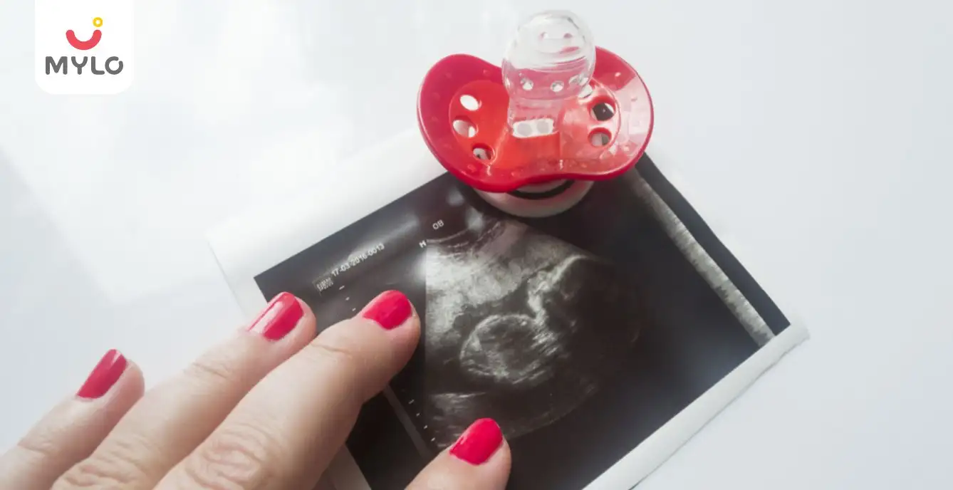 Image related to Conception