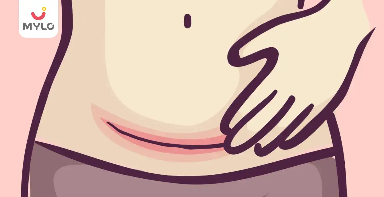 Image related to Sex Life