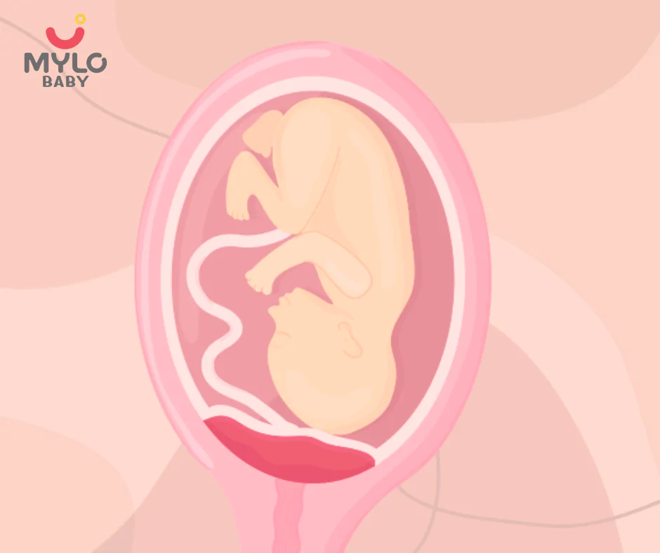 Image related to undefined