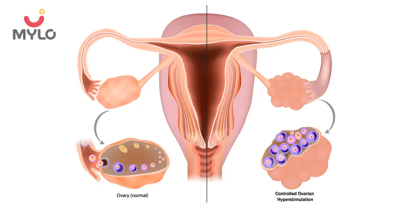 Ovarian Stimulation: Understanding the Process and What to Expect