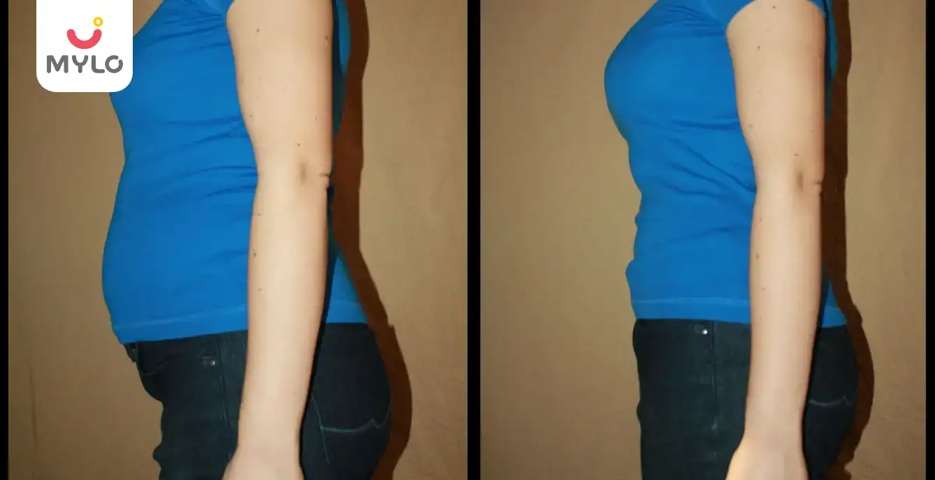 Image related to Weight Loss