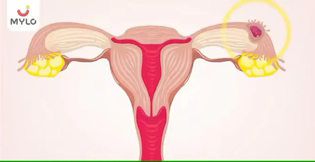 Image related to Pregnancy Journey