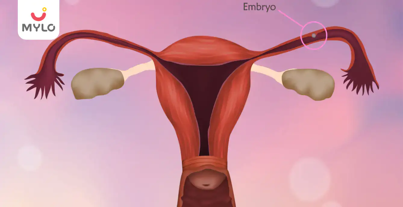 Image related to Ectopic Pregnancy