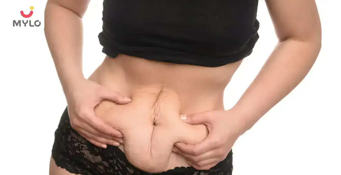 Image related to Post pregnancy weight loss Plan