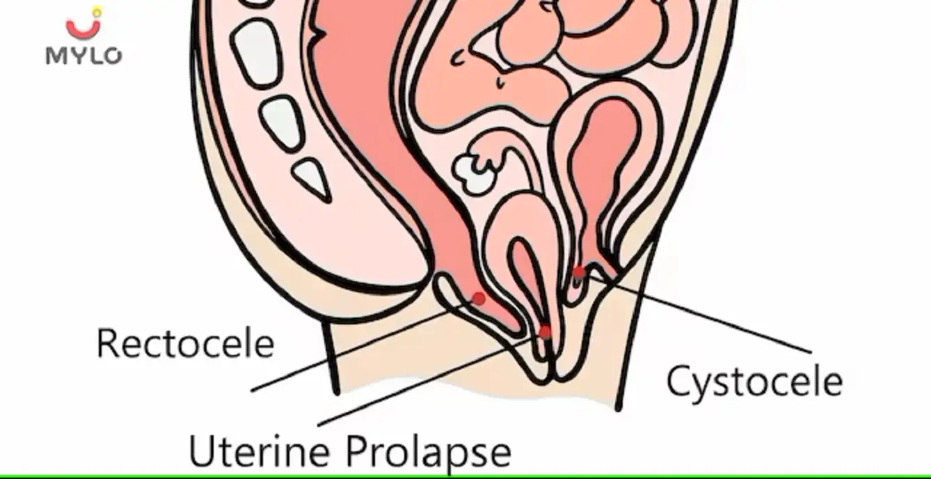 Image related to Symptoms & Illnesses