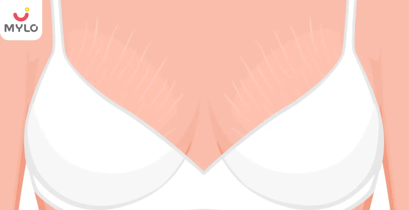 Image related to Breast Pain