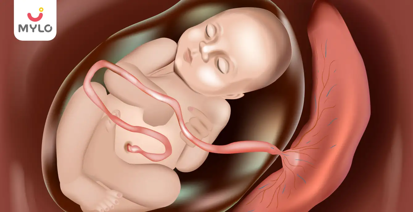 A Comprehensive Guide to Understanding Placenta Accreta