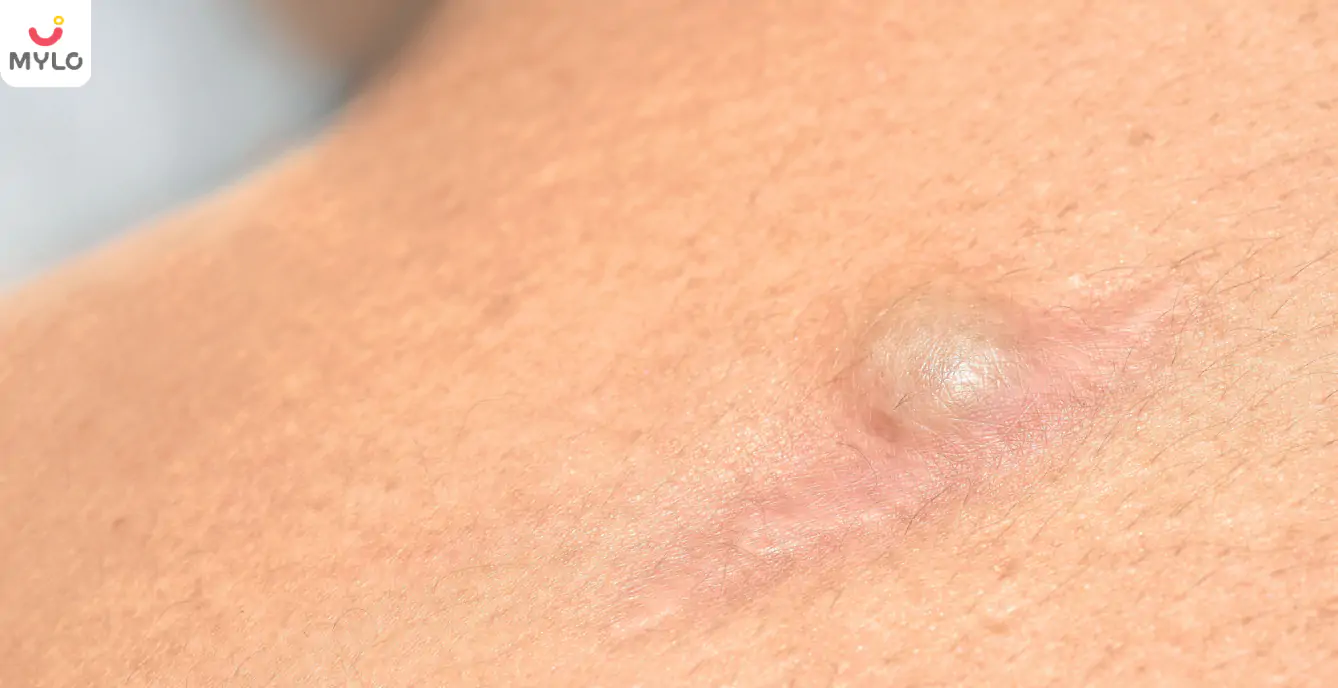 Image related to Skin Problems