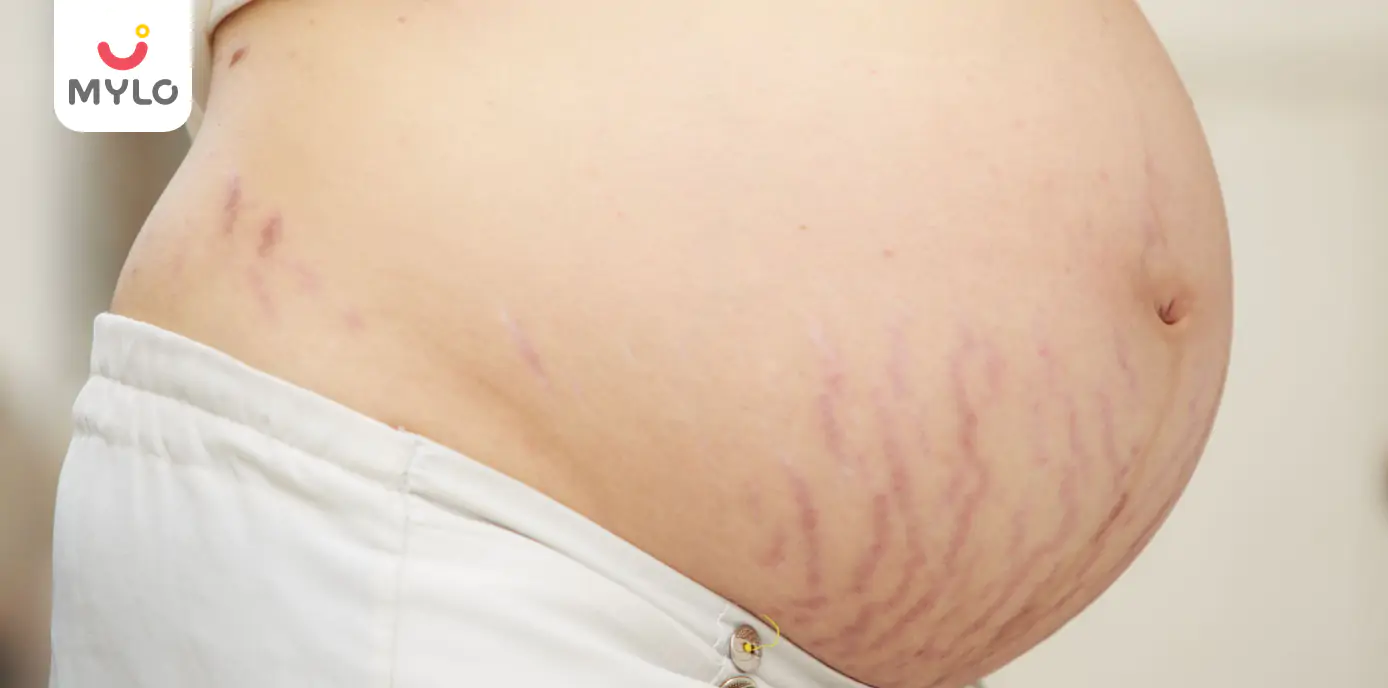 Reasons Why Stretch Marks Appear During Pregnancy?