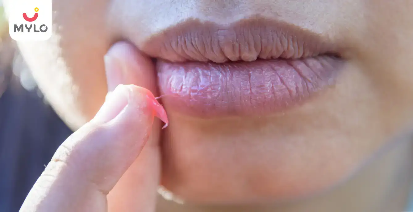 Lips Dry During Pregnancy: Symptoms and Causes 
