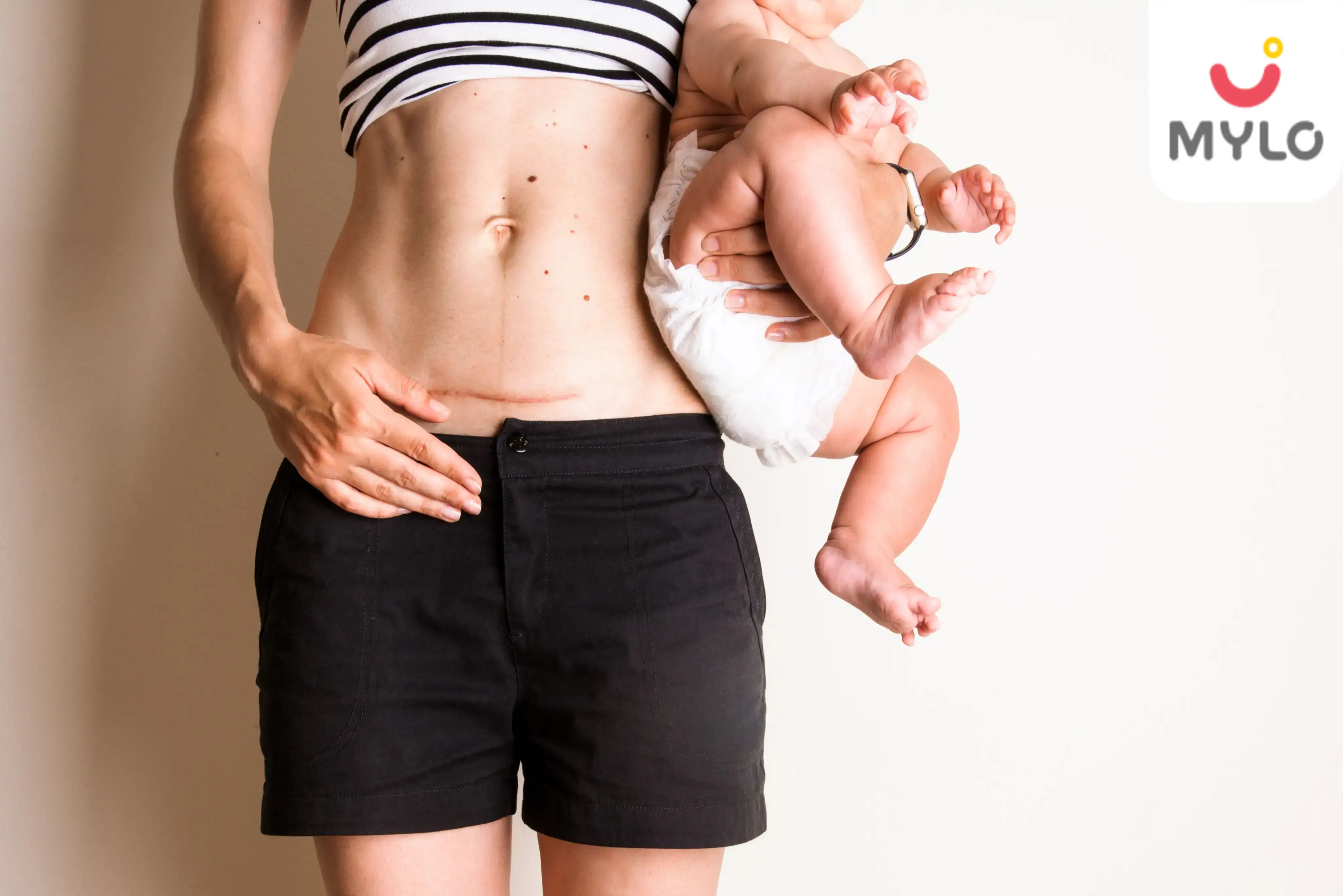 Image related to Postnatal Care