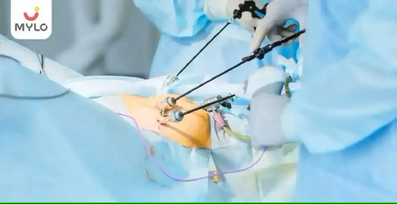 Image related to undefined